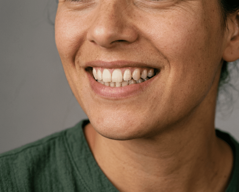 AI-illustratie bij hollywood smile: een natuurlijk, zelfstandig uitstralings- of dagelijks-levenconcept.