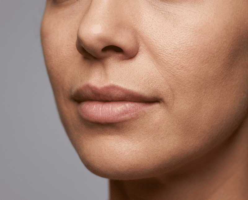 AI-illustratie bij hyaluronzuur fillers: een natuurlijk, zelfstandig uitstralings- of dagelijks-levenconcept.