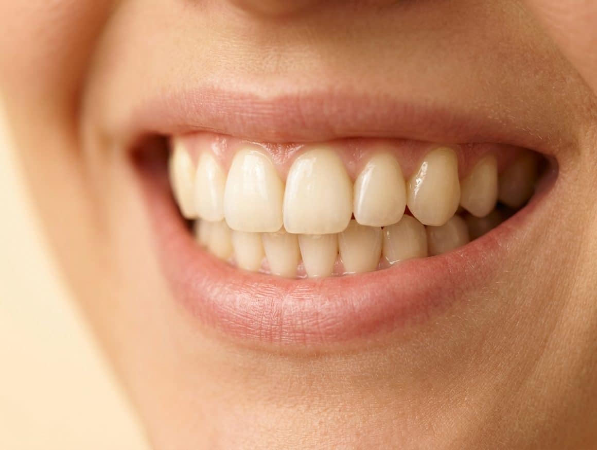 Metaalvrije implantaten behandeling