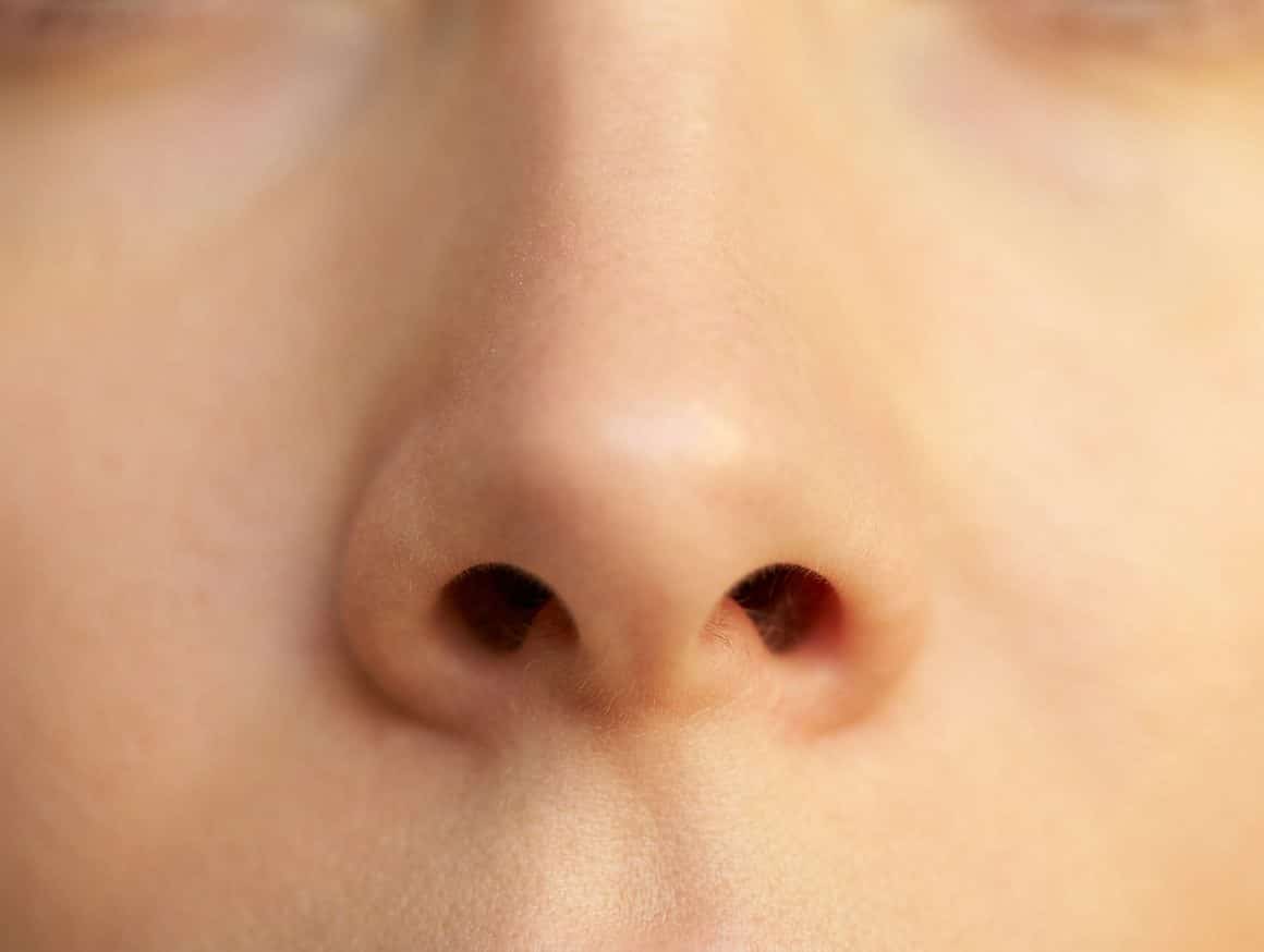 Neusgatchirurgie (Alarplasty) behandeling