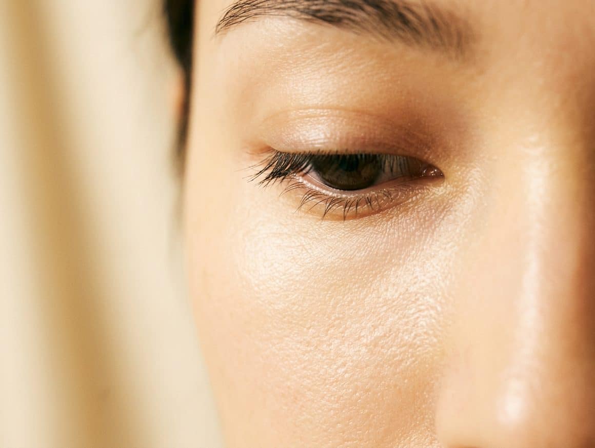 Platelet Rich Plasma Filler behandeling
